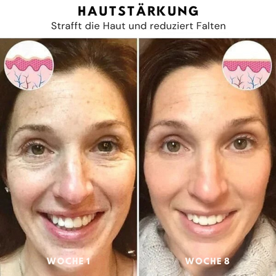 SkinLife™ | Botox Gesicht Serum