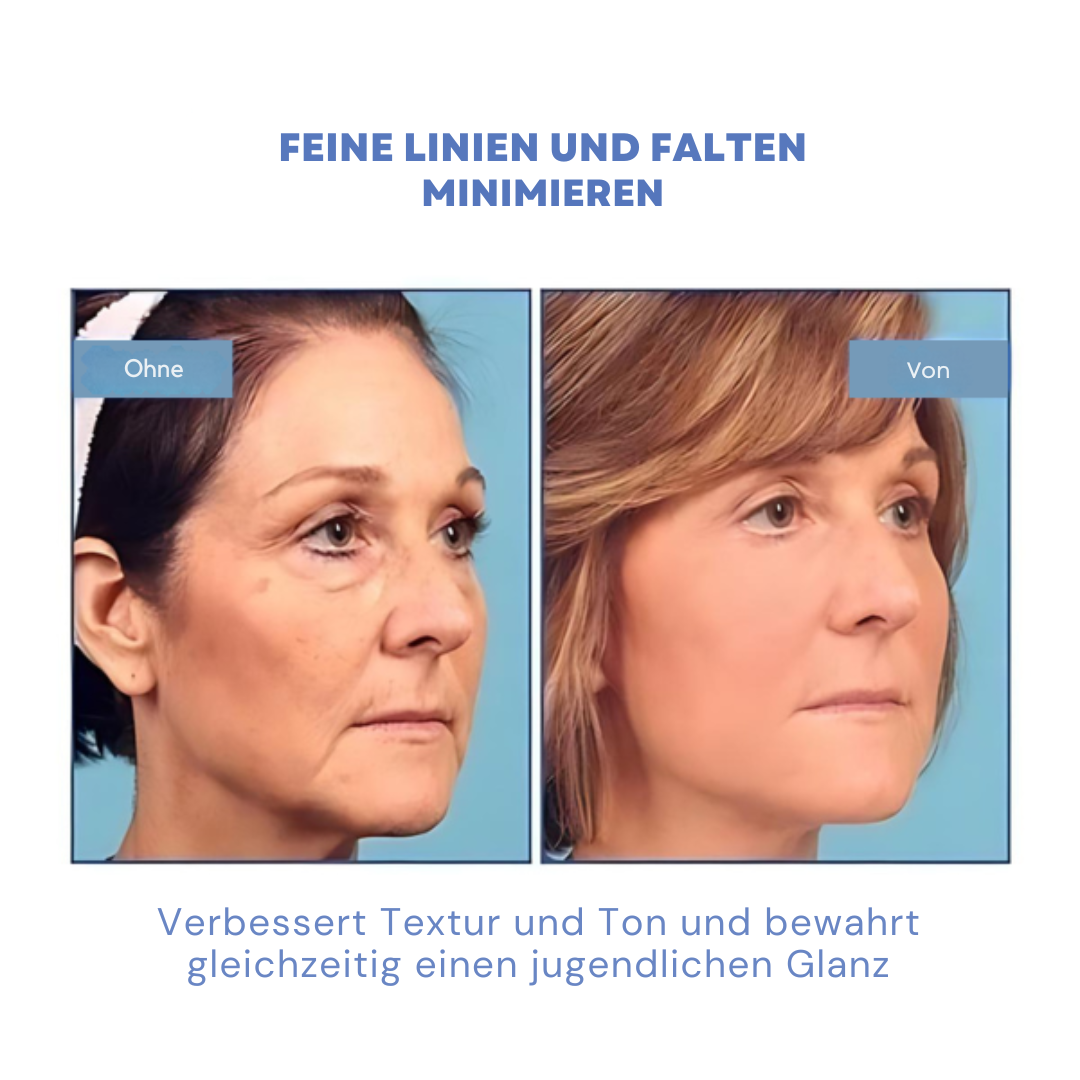 SkinLife™ | Botox Gesicht Serum