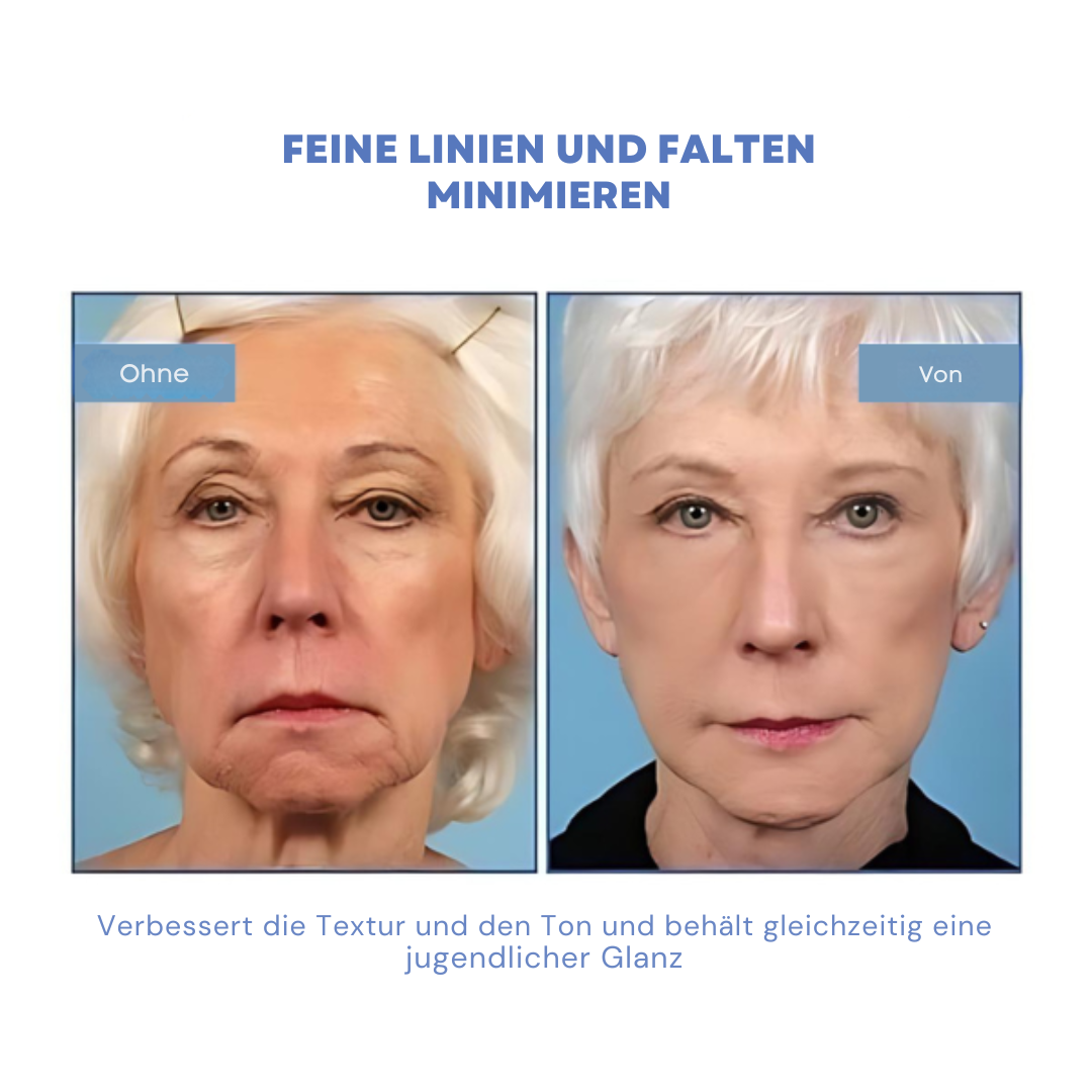 SkinLife™ | Botox Gesicht Serum
