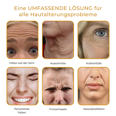 Antifalten-Botox-Creme™ | Botox Creme zur Faltenentfernung