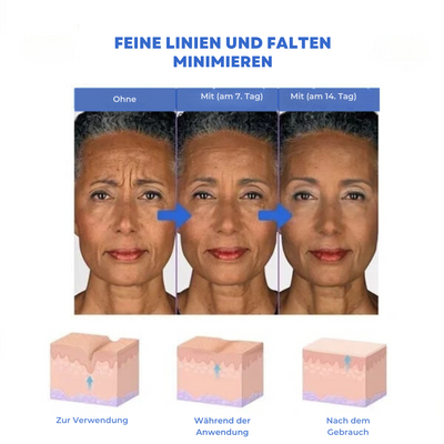 SkinLife™ | Botox Gesicht Serum