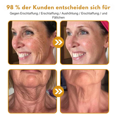 Antifalten-Botox-Creme™ | Botox Creme zur Faltenentfernung