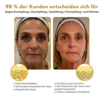 Antifalten-Botox-Creme™ | Botox Creme zur Faltenentfernung