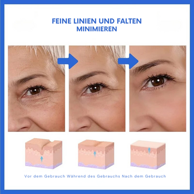 SkinLife™ | Botox Gesicht Serum