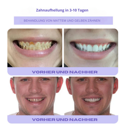 ZahnBlüte™ | Natürliche Zahnrestaurierung mit Mineralien