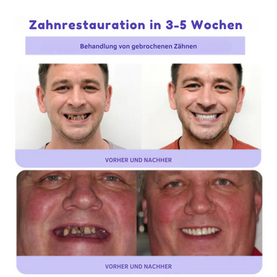 ZahnBlüte™ | Natürliche Zahnrestaurierung mit Mineralien