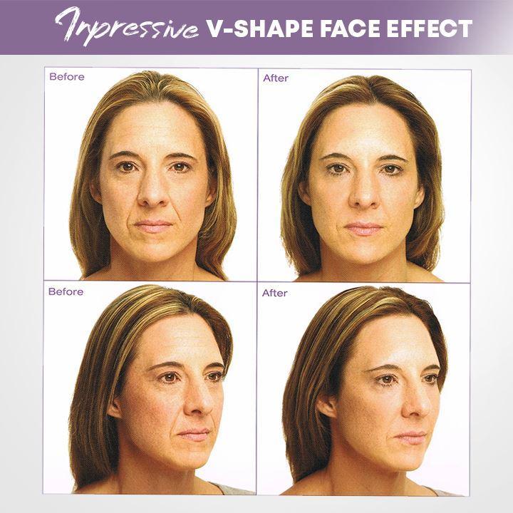 Visage | Unsichtbare Gesichtslifter Tape für straffere Haut