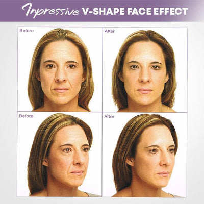 Visage | Unsichtbare Gesichtslifter Tape für straffere Haut