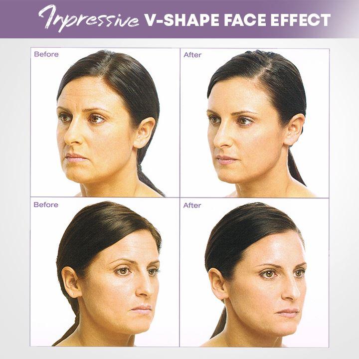 Visage | Unsichtbare Gesichtslifter Tape für straffere Haut