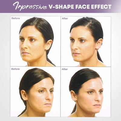 Visage | Unsichtbare Gesichtslifter Tape für straffere Haut
