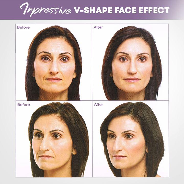 Visage | Unsichtbare Gesichtslifter Tape für straffere Haut