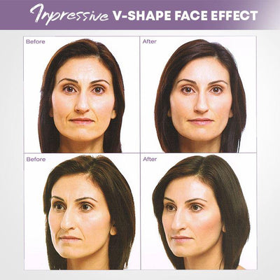 Visage | Unsichtbare Gesichtslifter Tape für straffere Haut